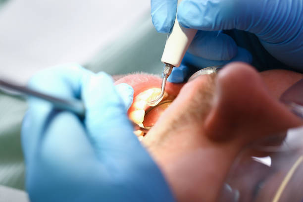 Best Emergency Dental Care for Abscessed Tooth in Whitinsville, MA
