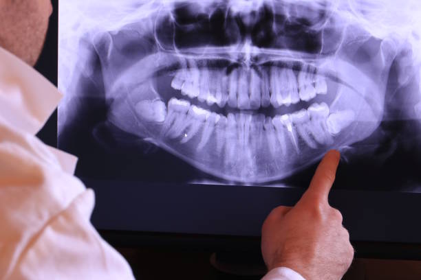 Best Broken or Cracked Tooth Emergency Dentist in Whitinsville, MA